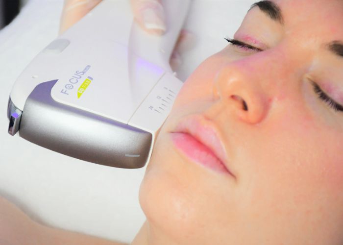 At Escape Aesthetics, we offer HIFU for Face